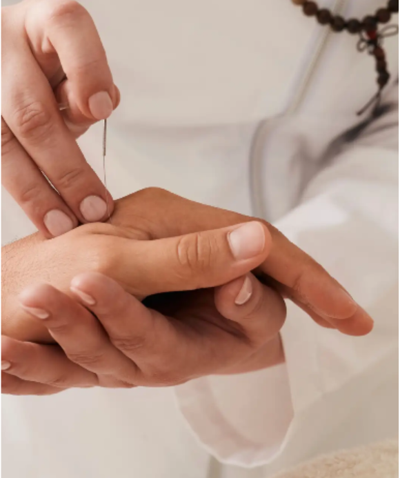Neuro acupuncture treatment at PurnaZen