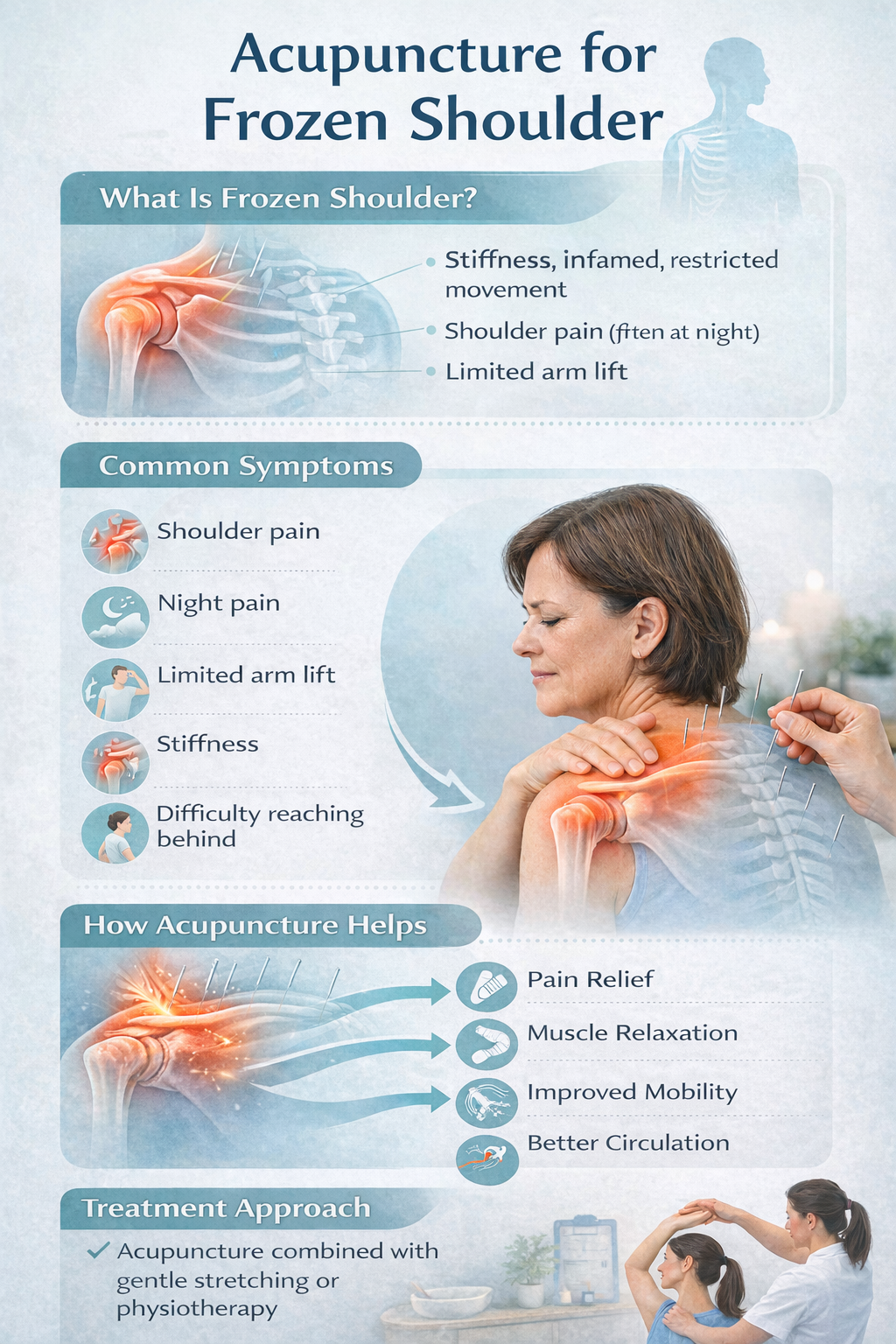 Acupuncture as a drug-free treatment for frozen shoulder