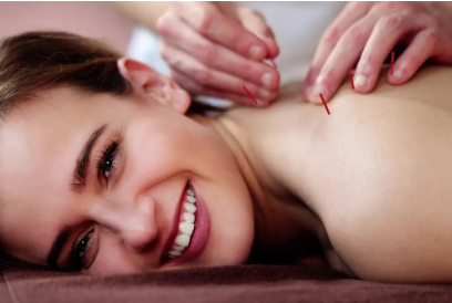TCM Acupuncture