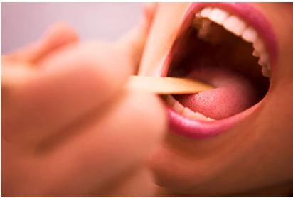 Tongue Diagnosis